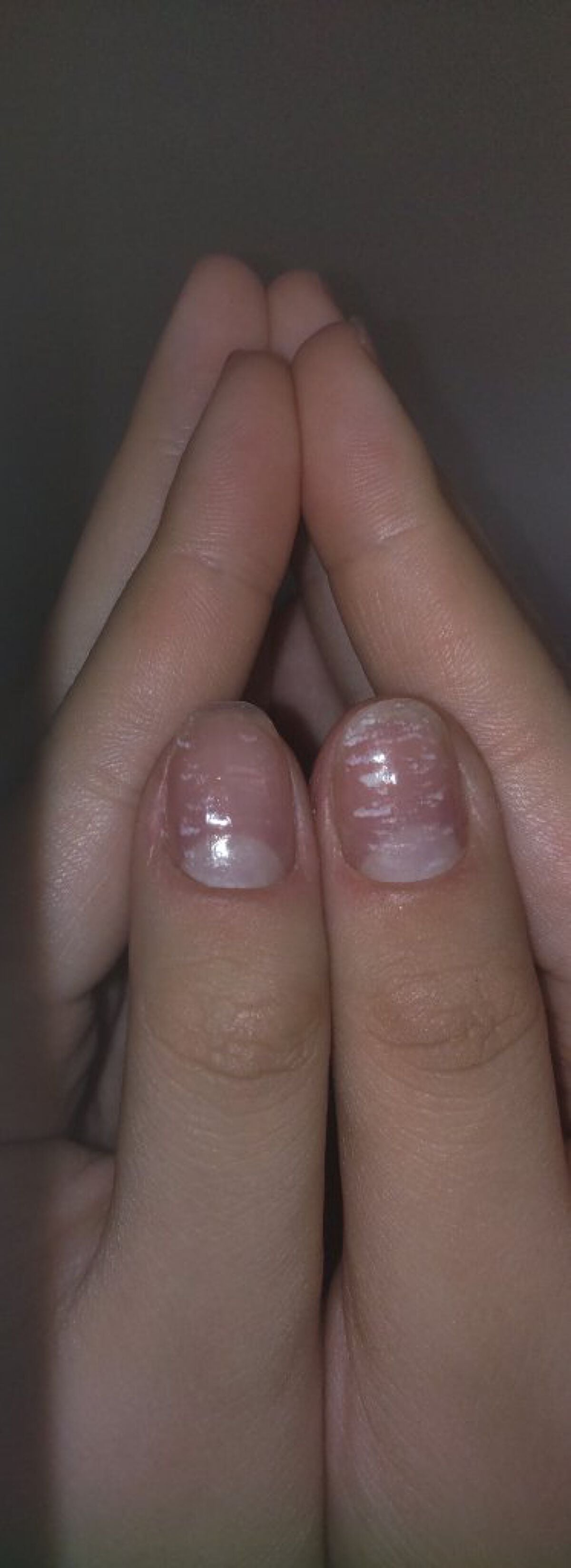 ð·ã¡ããã on LIPS ããä¹
ãã¶ãã§ãïŒð¥ºð¥ºçªã¯ã ãã¶æ¹åããŠããŸããïŒã§ãããæè¿ã®..ãïŒ1æç®ïŒ