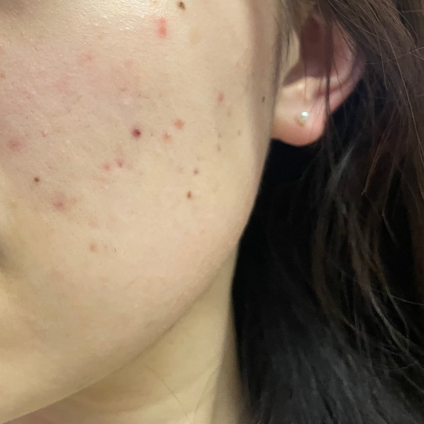 レッドブレミッシュ クリアスージングクリーム/Dr.G/フェイスクリームを使ったクチコミ(3枚目)