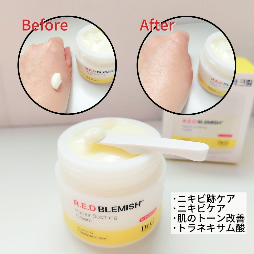 margaret on LIPS 「#PRDr.G\ニキビやシミのトラブル跡に/◆レッドブレミッシ..」(2枚目)