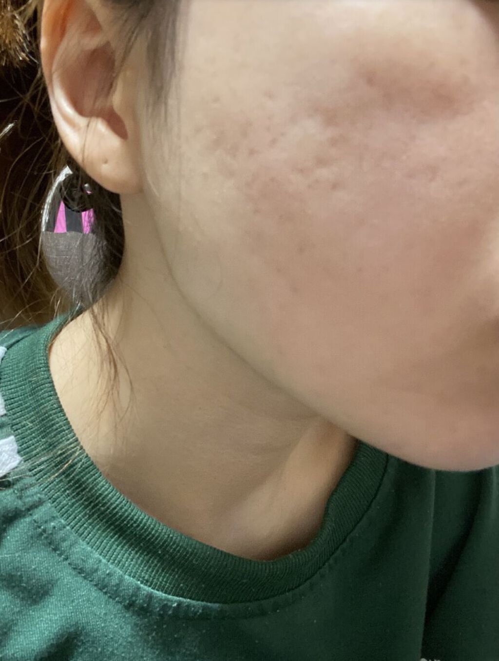 ホワイトニング クリアチャージ ウォーター/アルージェ/ミスト状化粧水を使ったクチコミ（1枚目）