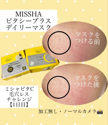 ミシャ ビタシープラス デイリーマスク【日本処方】/MISSHA/シートマスク・パックを使ったクチコミ(1枚目)
