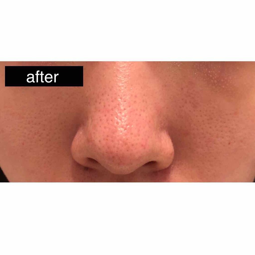 フェイシャル トリートメント クリア ローション/SK-II/化粧水を使ったクチコミ(3枚目)