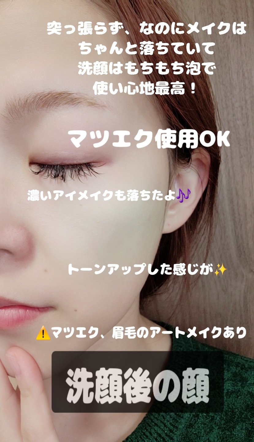 レッドラクトコラーゲンクリア2.0/MEDIPEEL/洗顔フォームを使ったクチコミ（2枚目）