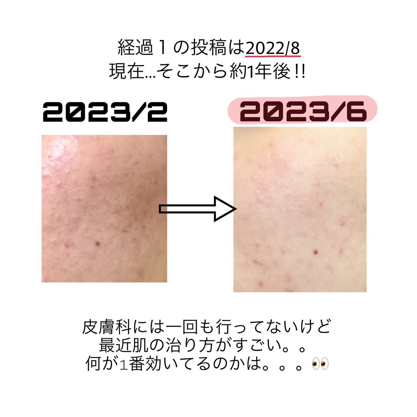 ミノン アミノモイスト ジェントルウォッシュ ホイップ/ミノン/泡洗顔を使ったクチコミ(2枚目)