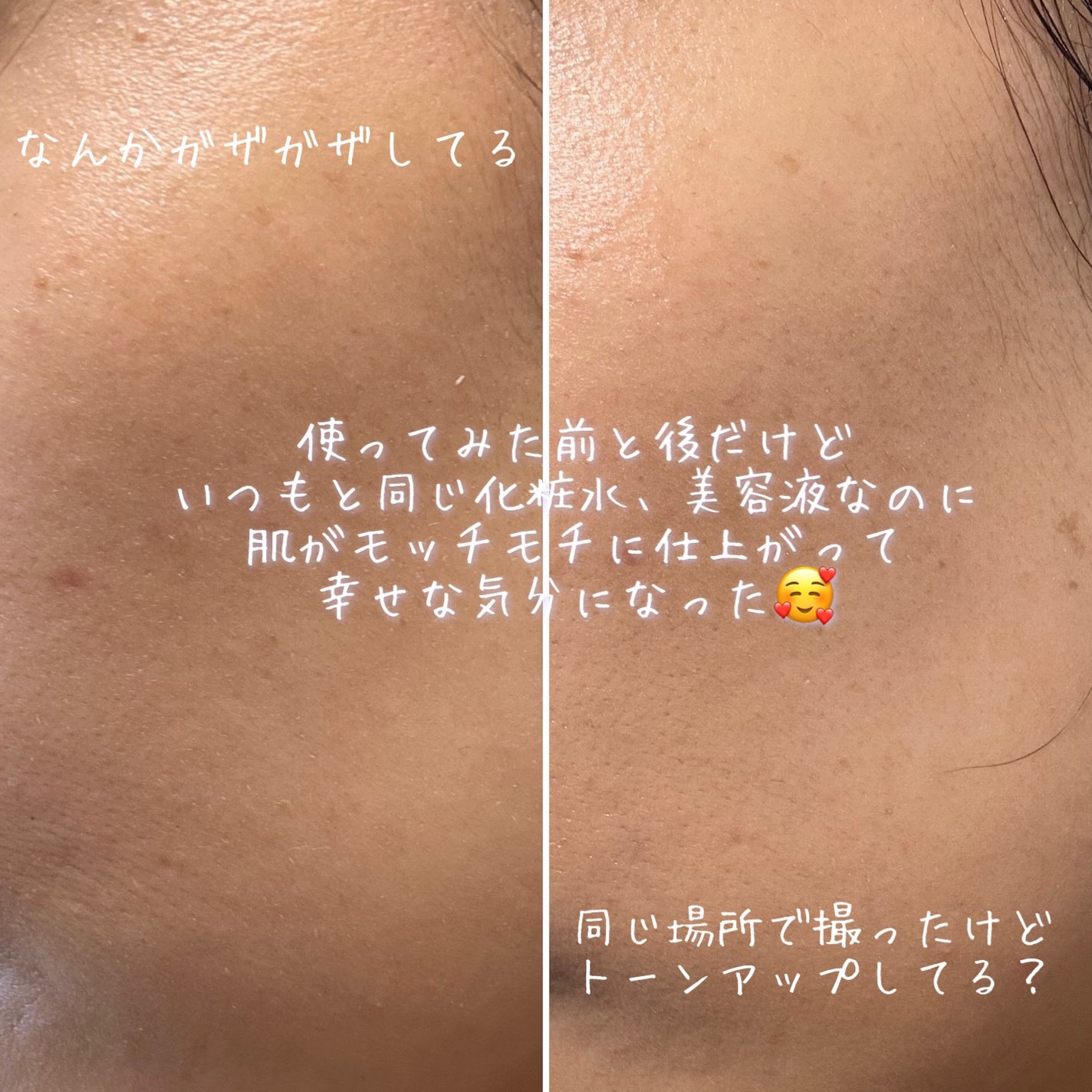 トータルフェイシャルプラス/MELLIFE/美顔器・マッサージを使ったクチコミ(7枚目)