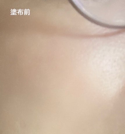 シカルファットプラス リペアミルク/アベンヌ/乳液を使ったクチコミ(3枚目)