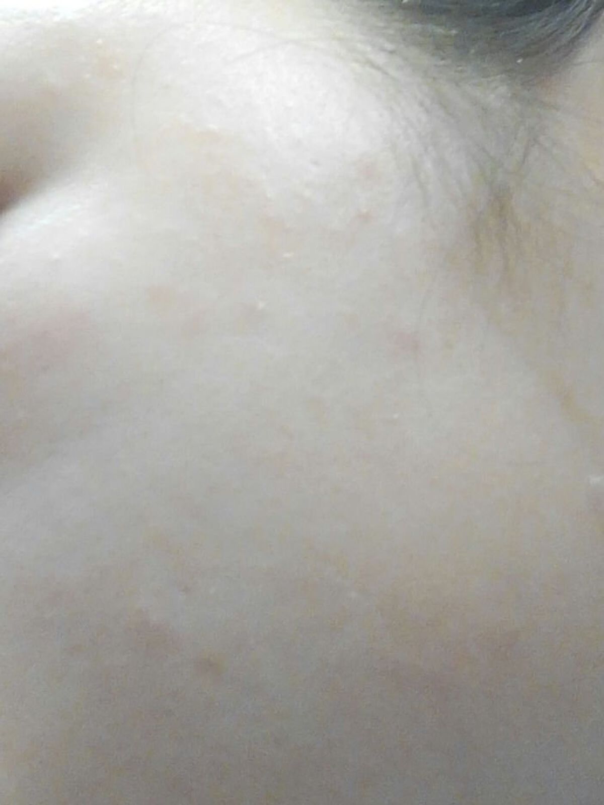 薬用クリア化粧水/メンソレータム アクネス/化粧水を使ったクチコミ（3枚目）