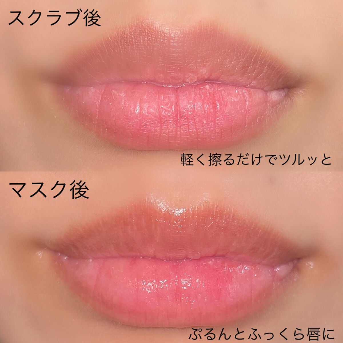 リップエイド集中マスク/トレンドホリック/リップマスクを使ったクチコミ(5枚目)