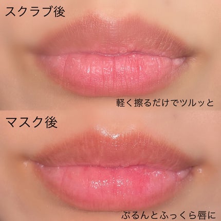 リップエイド集中マスク/トレンドホリック/リップマスクを使ったクチコミ(5枚目)