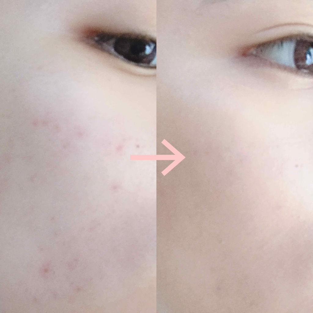 M クッション ファンデーション(モイスチャー)/MISSHA/クッションファンデーションを使ったクチコミ（3枚目）