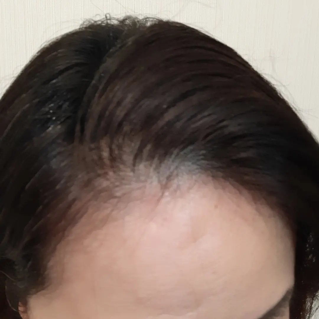 ANGY888 on LIPS 「どうしても髪のボリュームがなくなってきたのが気になる今日この頃..」(3枚目)