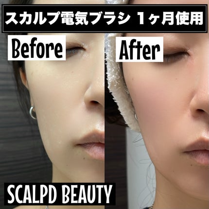 スカルプ電気ブラシ|アンファー(スカルプD)の効果に関する スカルプ電気ブラシ|アンファー(スカルプD)の効果に関する
