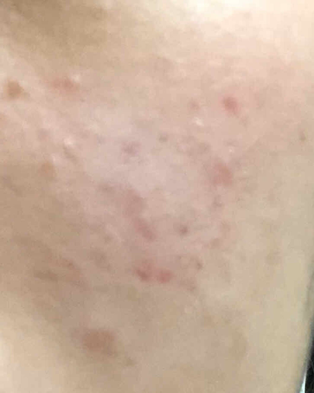 ハトムギ保湿ジェル(ナチュリエ スキンコンディショニングジェル)/ナチュリエ/美容液を使ったクチコミ(2枚目)