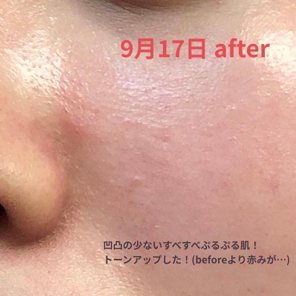 導入化粧液/無印良品/ブースター・導入液を使ったクチコミ(7枚目)