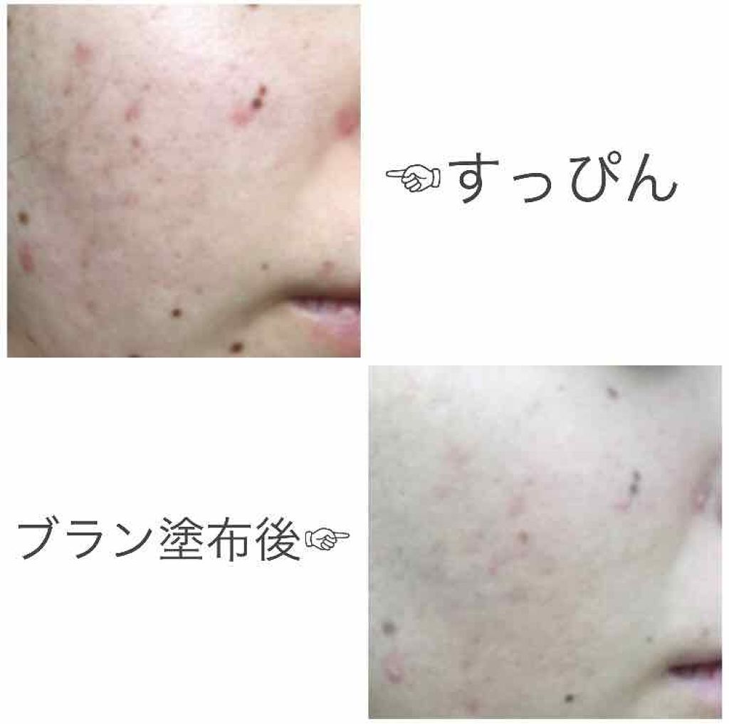 ブラン エクスペール クッションコンパクト H/LANCOME/クッションファンデーションを使ったクチコミ(4枚目)