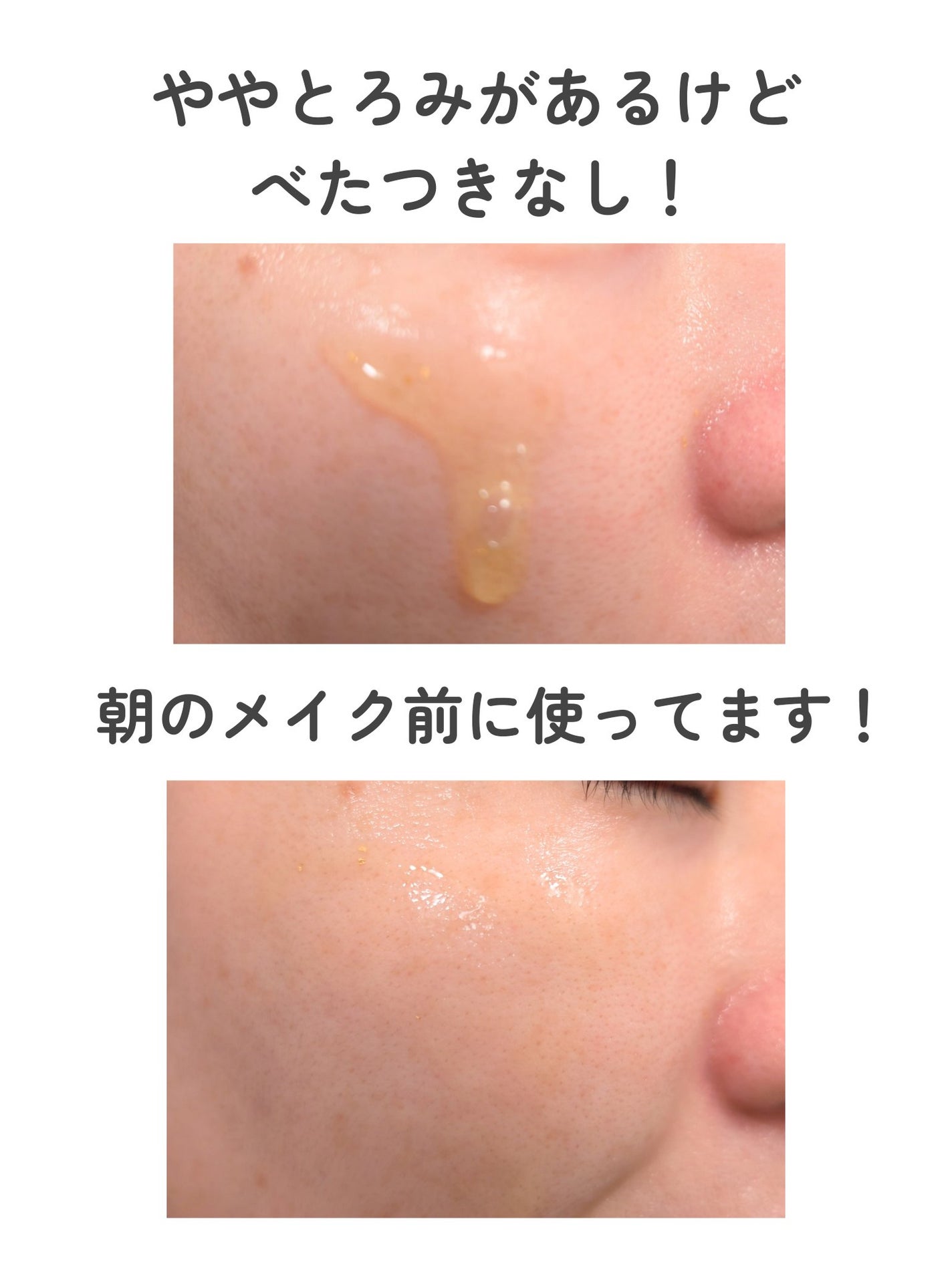 ゴールドビタミンC13%アンプル/Ariul/美容液を使ったクチコミ(5枚目)