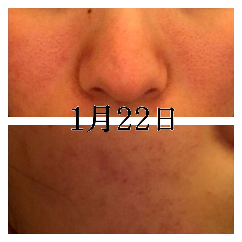 化粧水・敏感肌用・しっとりタイプ/無印良品/化粧水を使ったクチコミ(3枚目)