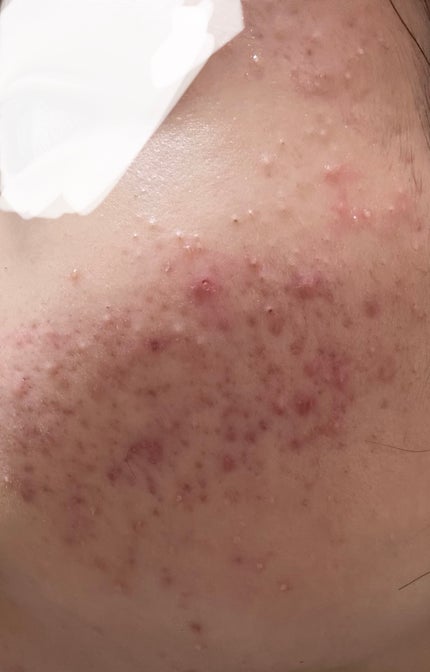 を使ったクチコミ(2枚目)