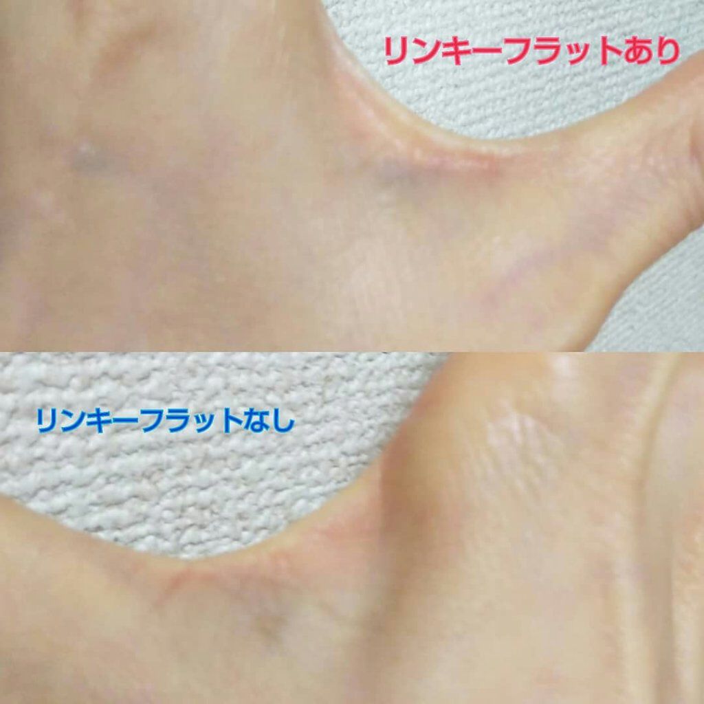 リンキーフラット/北の快適工房/美容液を使ったクチコミ(4枚目)