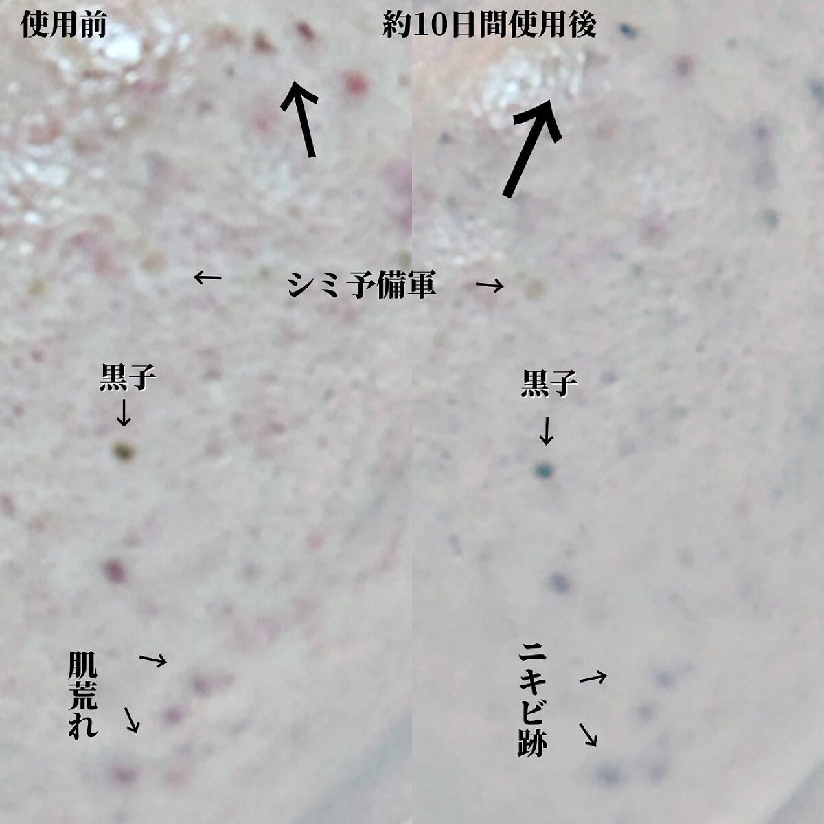 RXザ・ビタミンC23セラム/COSRX/美容液を使ったクチコミ（3枚目）