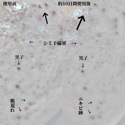 RXザ・ビタミンC23セラム/COSRX/美容液を使ったクチコミ(3枚目)