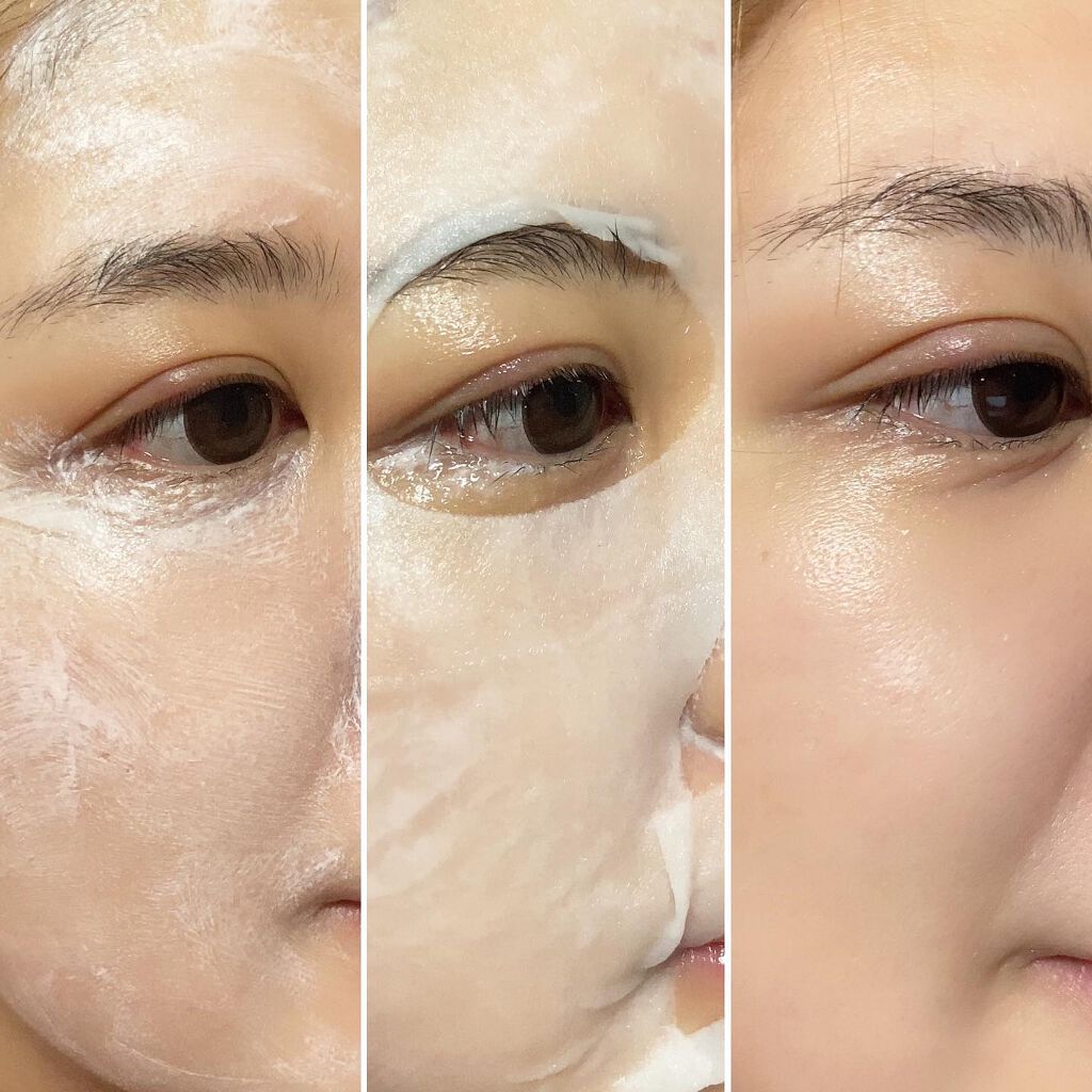 トラブルペアーマスク/DEWYCEL/シートマスク・パックを使ったクチコミ(3枚目)