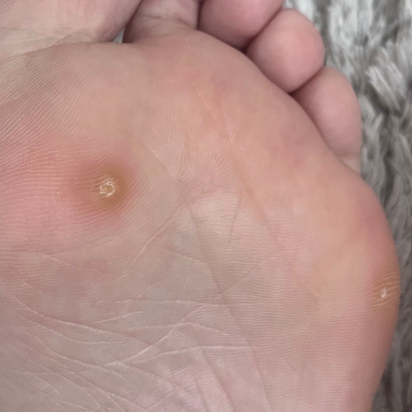 べっぴんはとむぎ/タマチャンショップ/食品を使ったクチコミ(1枚目)