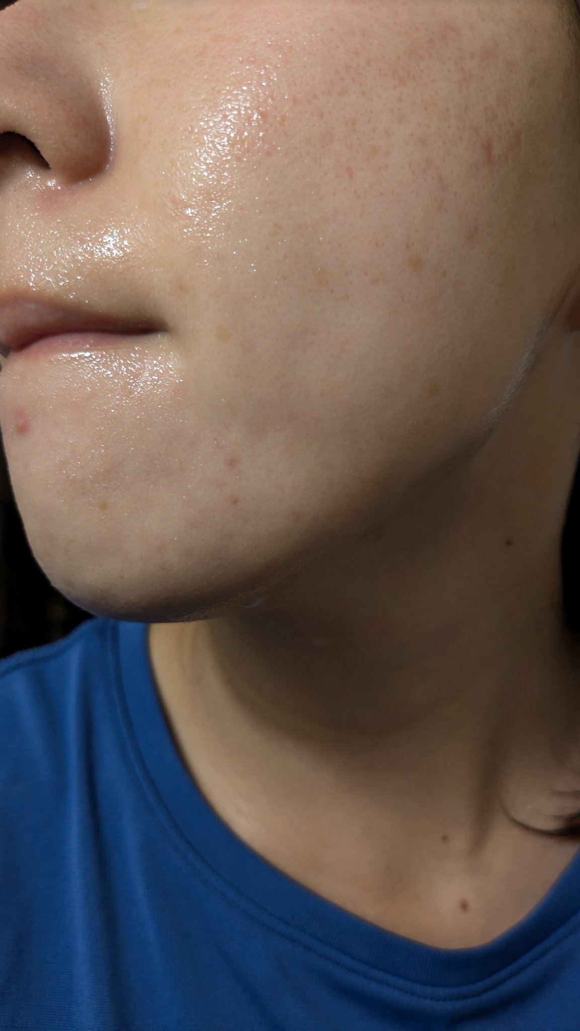 A2+NAG2ソリューション/The Ordinary/美容液を使ったクチコミ（2枚目）