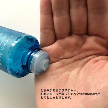 薬用マイクロバブルローション/Macchia Label/化粧水を使ったクチコミ（4枚目）