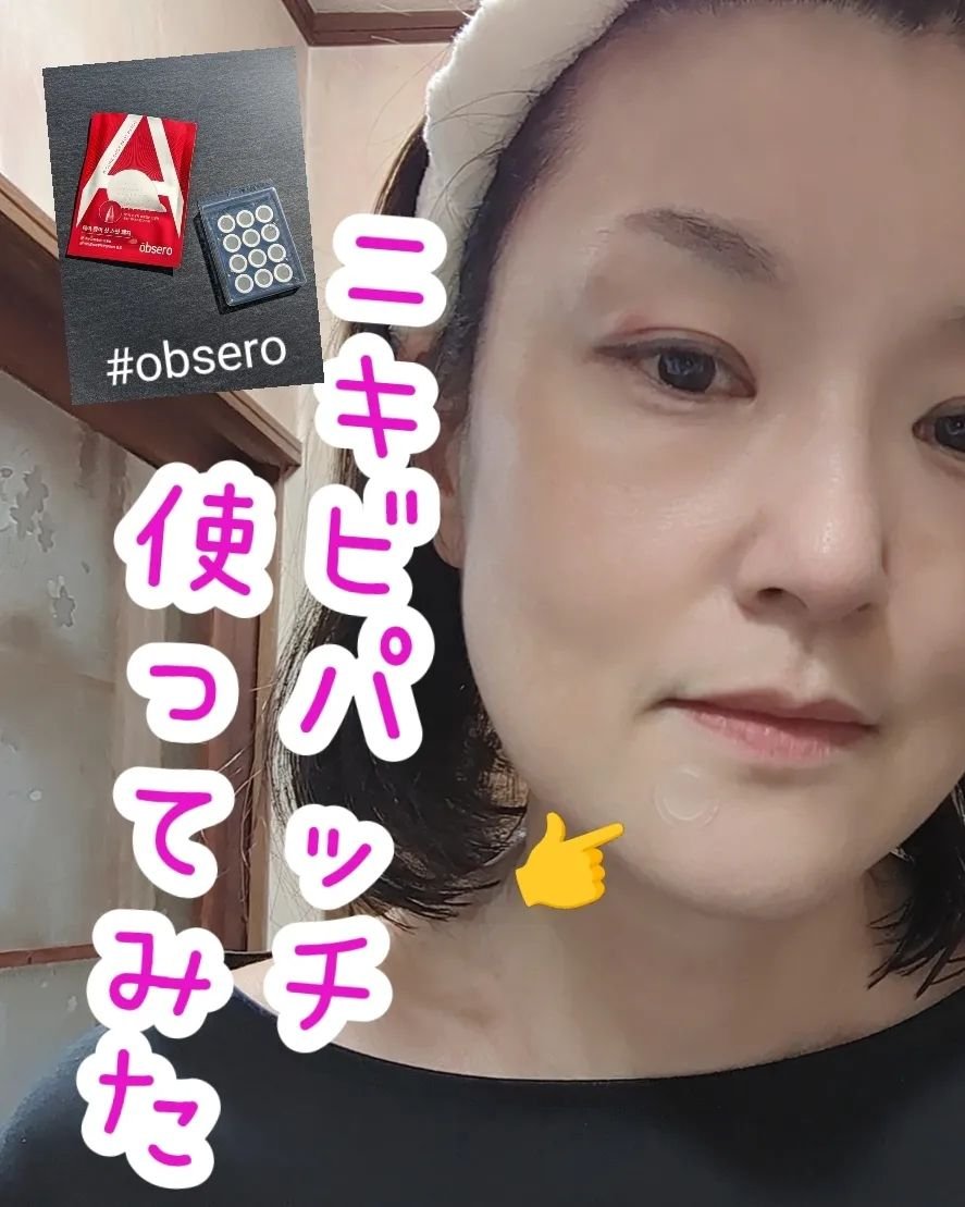 エーキュアショットスポットパッチ/obsero/にきびパッチを使ったクチコミ（1枚目）