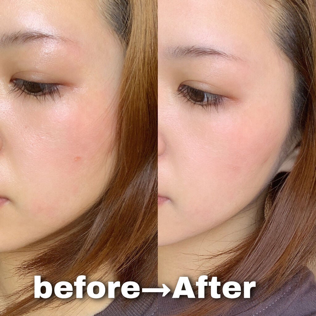 リサラット/ニカプラス/フェイスクリームを使ったクチコミ(6枚目)