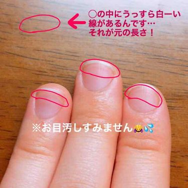 Ac キューティクルオイル Ac Makeupの口コミ 実写の指の写真あります 花粉症が辛くな By Riiiwa 混合肌 10代後半 Lips
