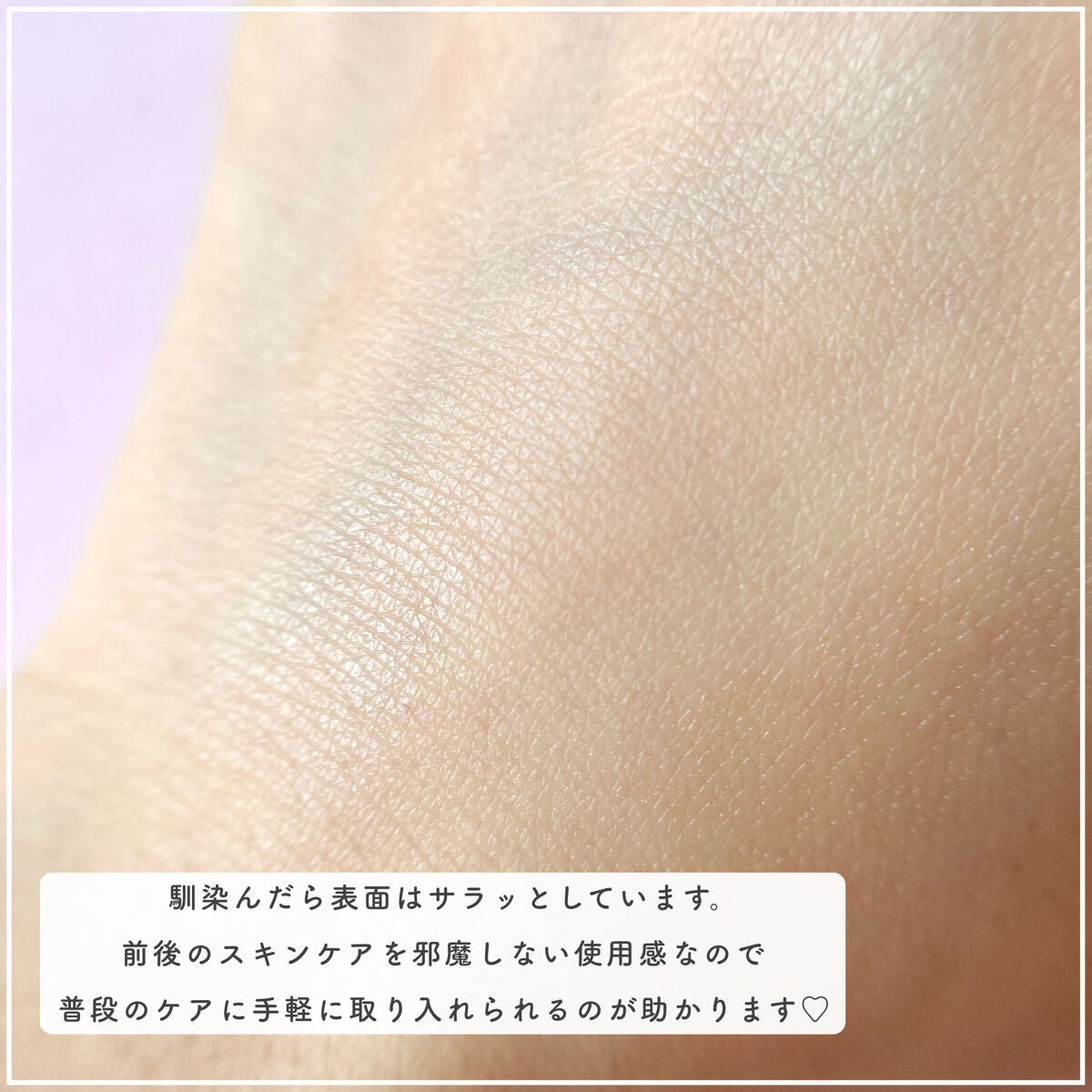 ピンクティーツリーシナジーセラム/APLIN/美容液を使ったクチコミ(6枚目)