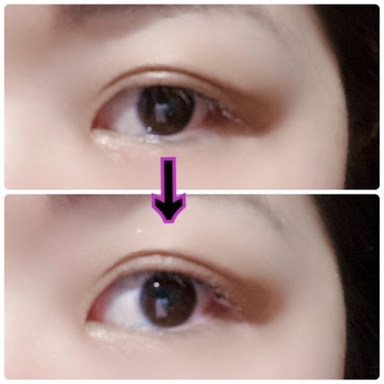 メザイク イージークリア 接着クリアタイプ/メザイク/二重まぶた用アイテムを使ったクチコミ(6枚目)