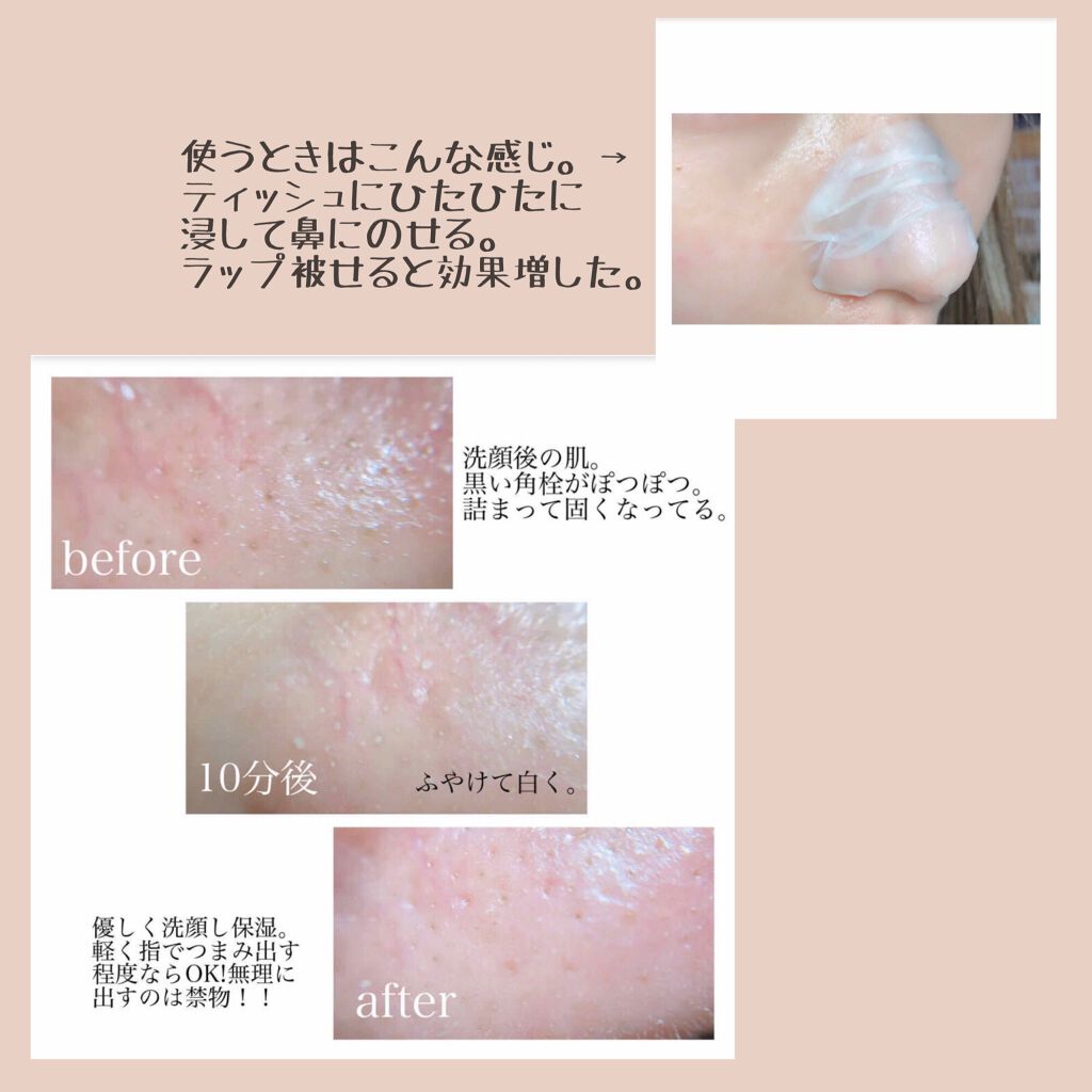 エマルジョンリムーバー　300ml/200ml/水橋保寿堂製薬/その他洗顔料を使ったクチコミ（3枚目）