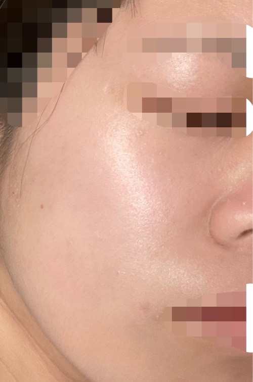 イルミネイティングフィニッシュパウダー　～Abloom～/キャンメイク/プレストパウダーを使ったクチコミ（3枚目）