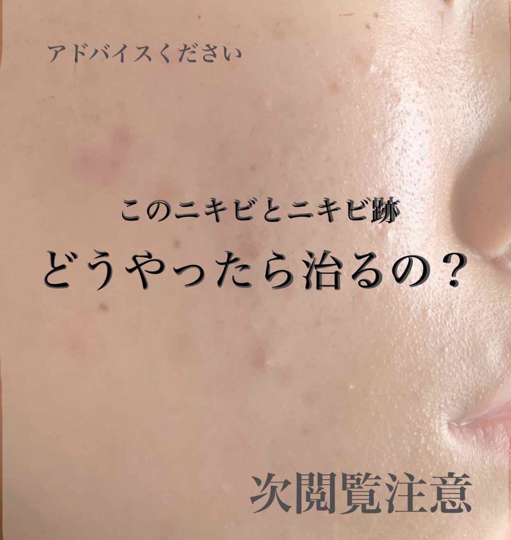 乳液・敏感肌用・しっとりタイプ/無印良品/乳液を使ったクチコミ（1枚目）