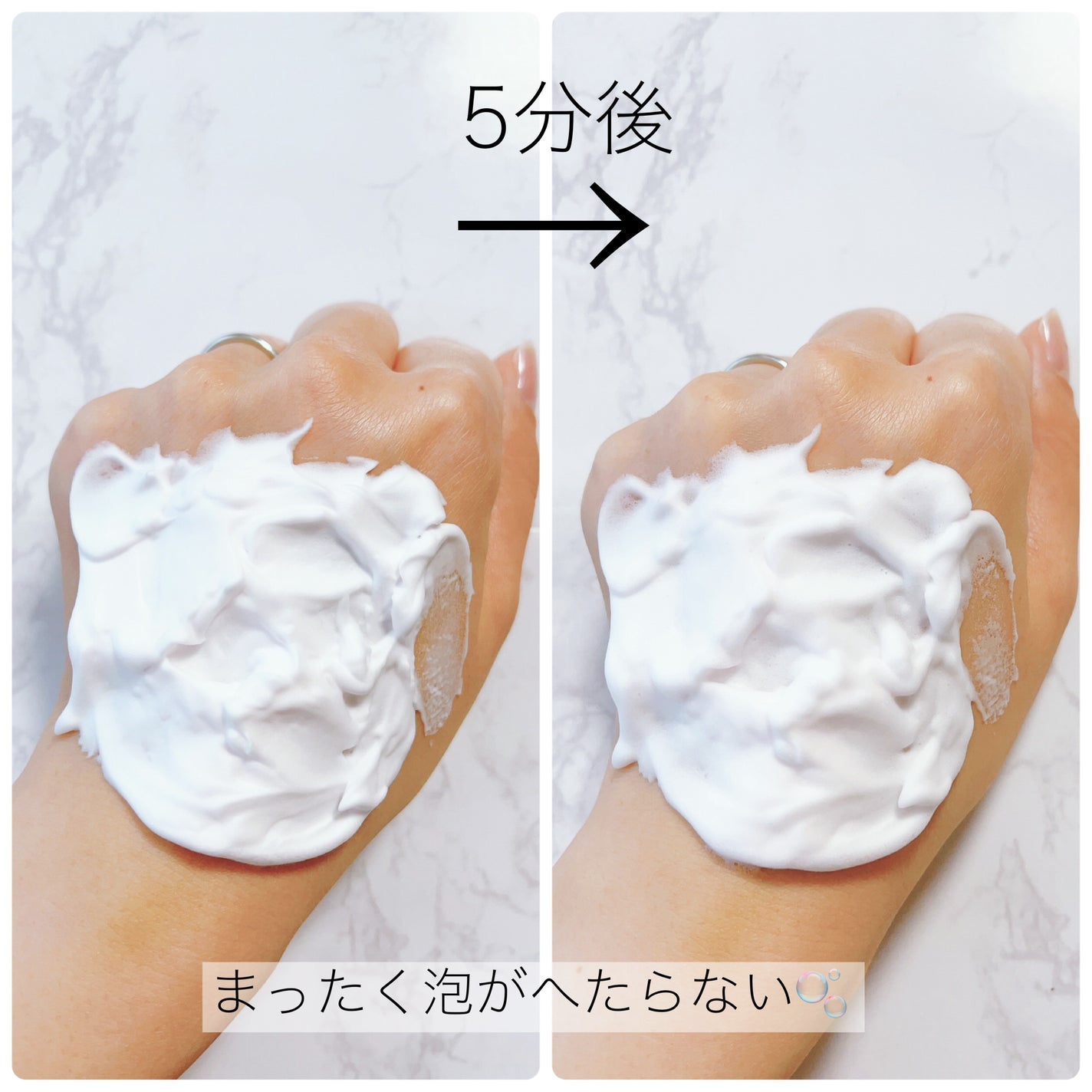 泡の柔肌パック/ドモホルンリンクル/洗い流すパック・マスクを使ったクチコミ(4枚目)