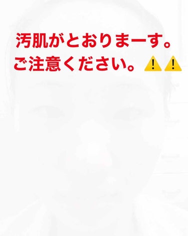 ニキビ肌をもう、脱出したい😭😭😭

お久しぶりです！！！
今の時期はお年玉が入る時期ですねー
と、言うことで！！私は決めました！
悪化したニキビ肌からもう脱出したい😢
なので、今まで使った中で1番効果を