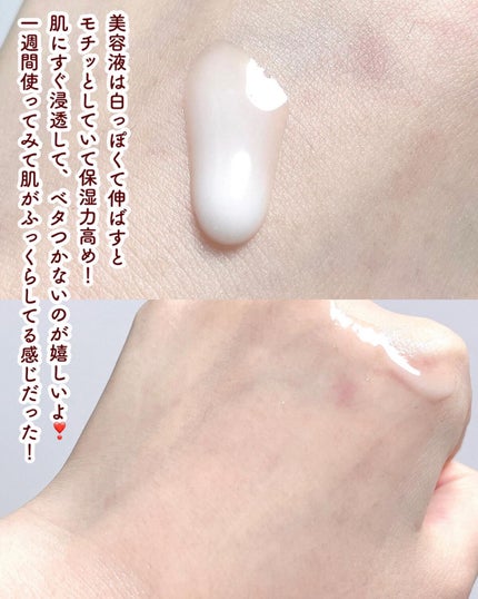 プロバイオダーム リフティング クリーム/BIOHEAL BOH/フェイスクリームを使ったクチコミ(4枚目)