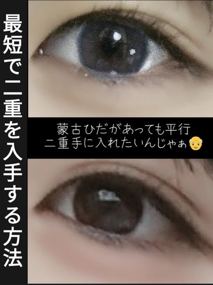 ケアリーヴ/ニチバン/その他を使ったクチコミ(1枚目)