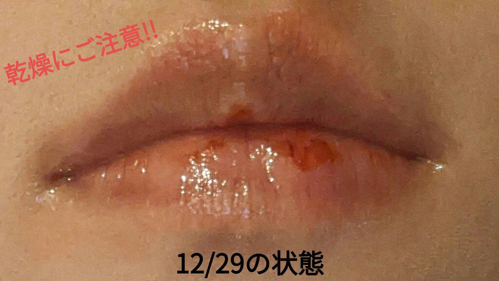 ニベアリップケア ウォータリングリップ/ニベア/リップケアを使ったクチコミ（1枚目）