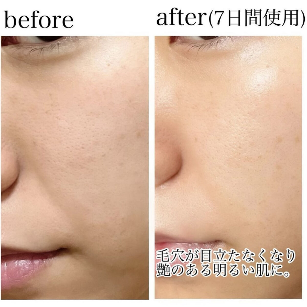 ナチュラルグロウエッセンス/inersential/美容液を使ったクチコミ（3枚目）