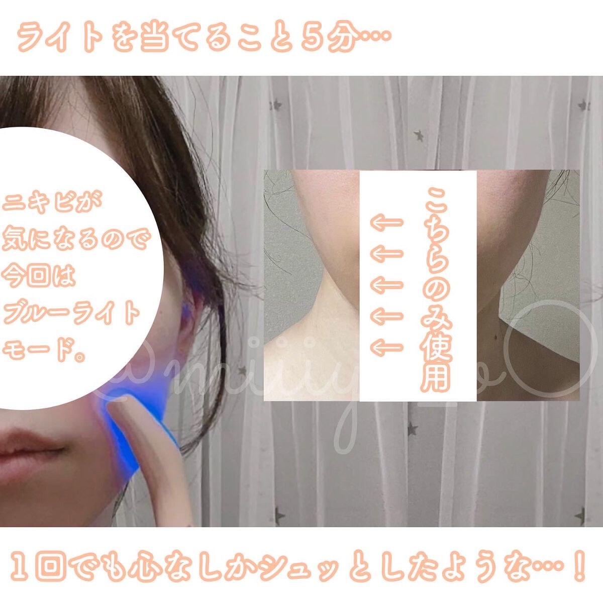 イオン導入美顔器フォトマックス /ar&ar /美顔器・マッサージを使ったクチコミ（3枚目）