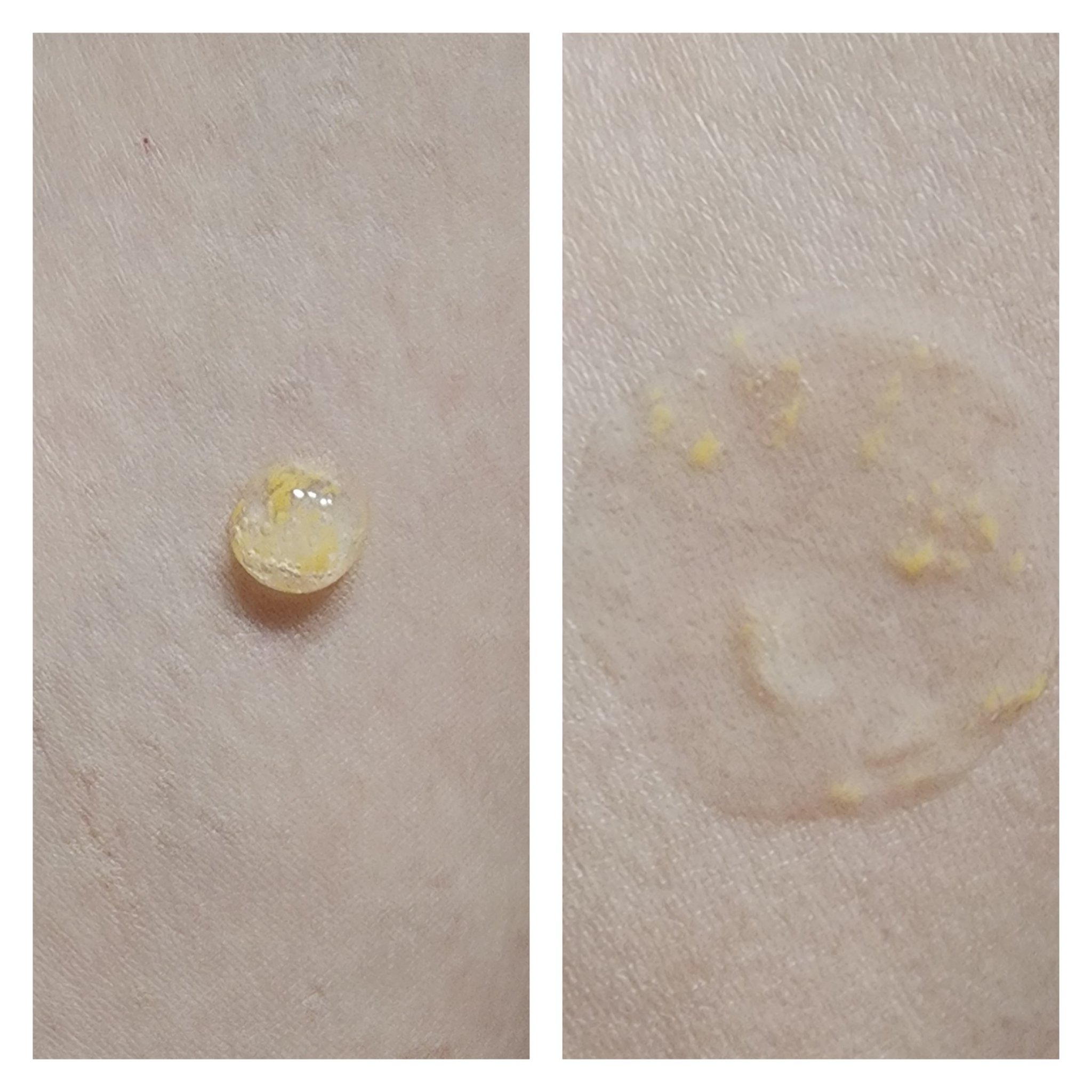 CPセラム PV 美容液/カプセルセラム/美容液を使ったクチコミ（3枚目）