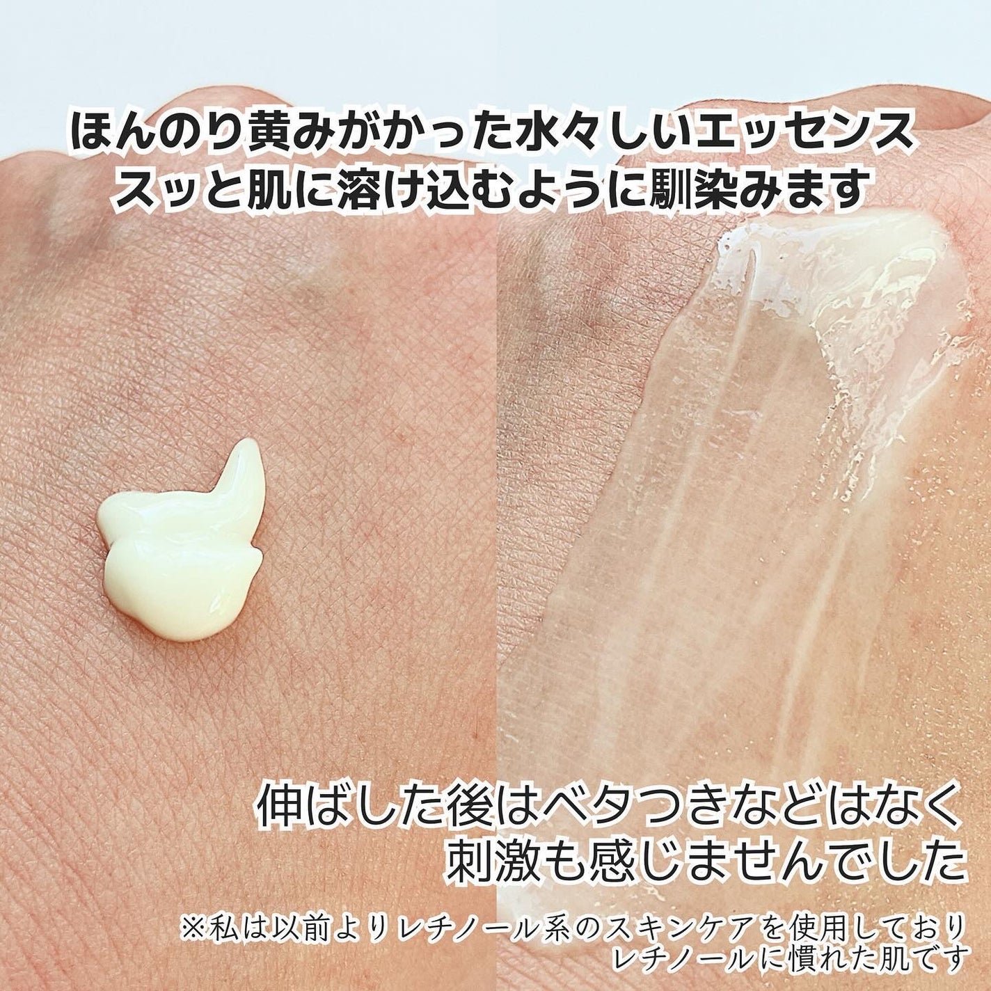 シカレチA エッセンス0.3/VT/美容液を使ったクチコミ(3枚目)