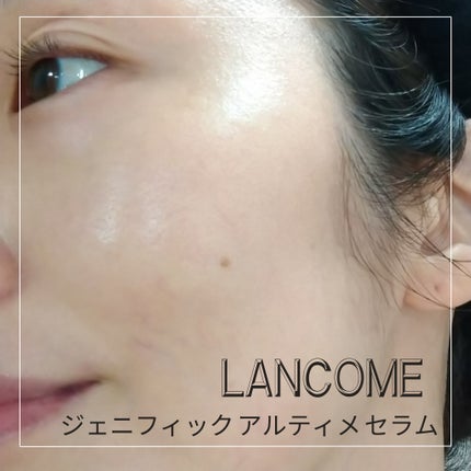 ジェニフィック アルティメ セラム/LANCOME/美容液を使ったクチコミ(3枚目)
