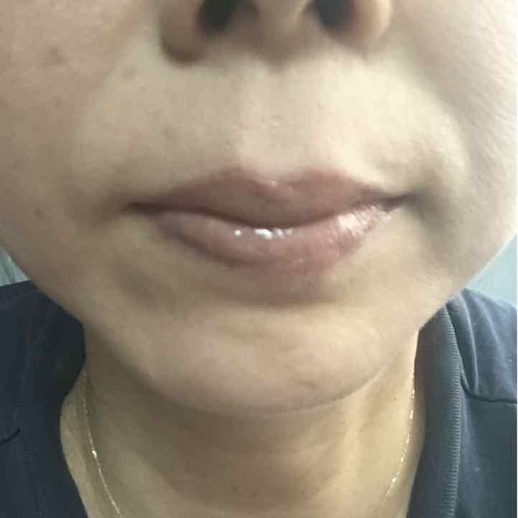 HOLD LIVE/HOLDLIVE/口紅を使ったクチコミ（2枚目）