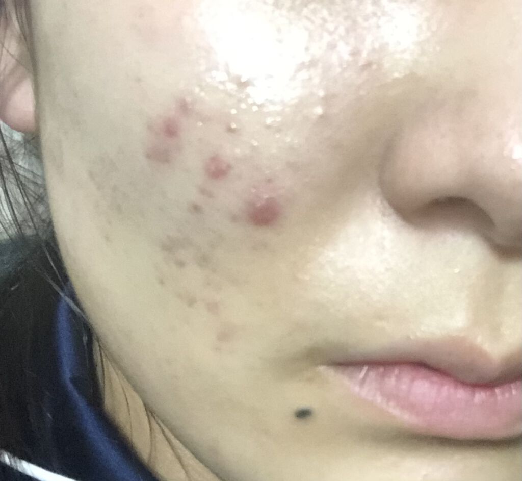 を使ったクチコミ（1枚目）