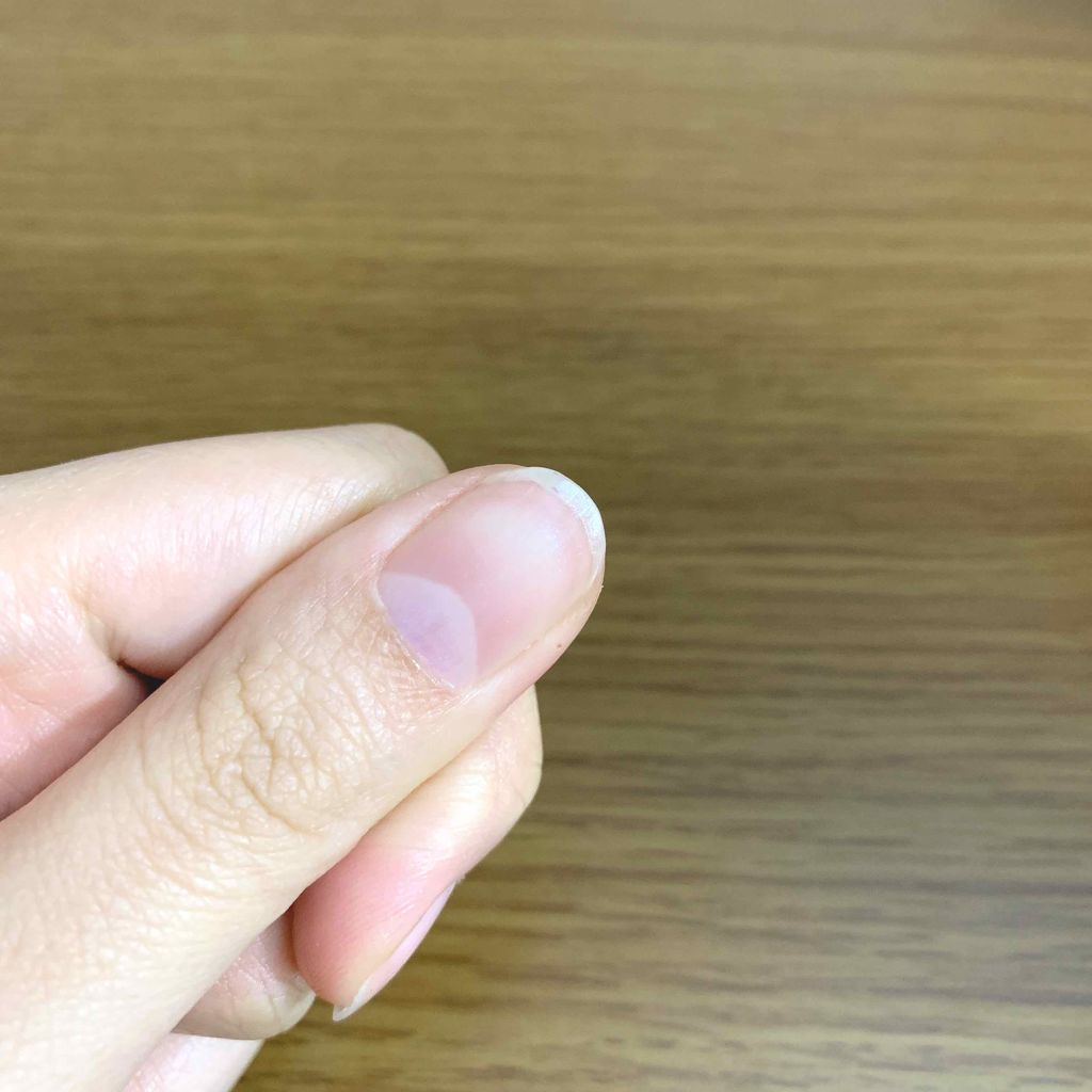 ネイルケアオイル 無印良品の口コミ 最近 爪の表面がボコボコしてる W By ハリー 混合肌 代前半 Lips